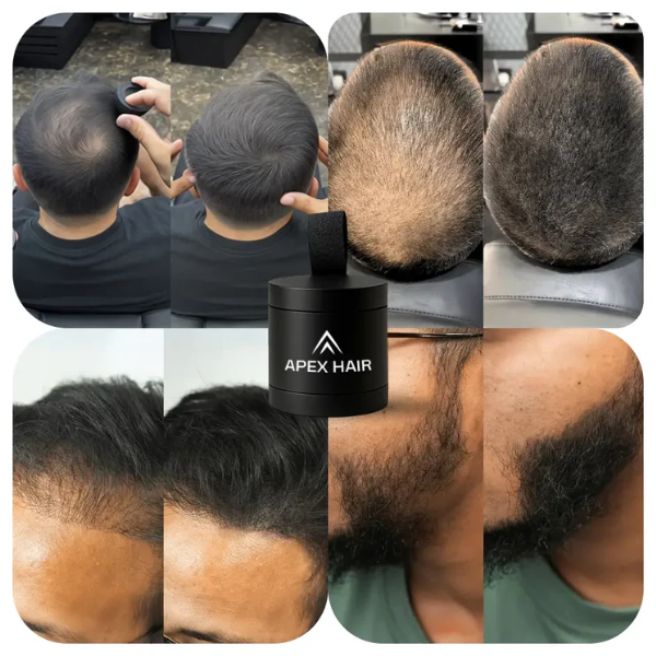 Apex Hair™ – Professional Hair Camouflage