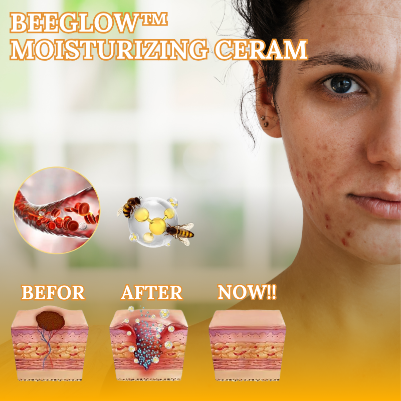 BeeGlow™- Bee Venom Therapy for Pain and Inflammation