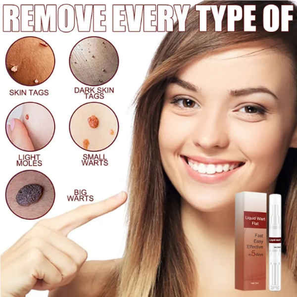 SkinClean™ - Tags & Moles Remover