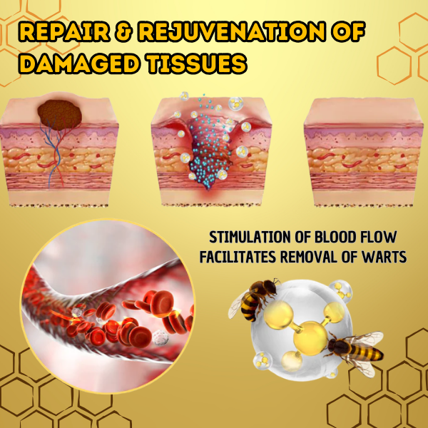 BeePure™ - 7-Day Wart Removal Treatment 🐝