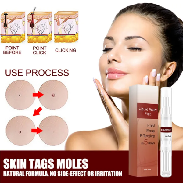 SkinClean™ - Tags & Moles Remover